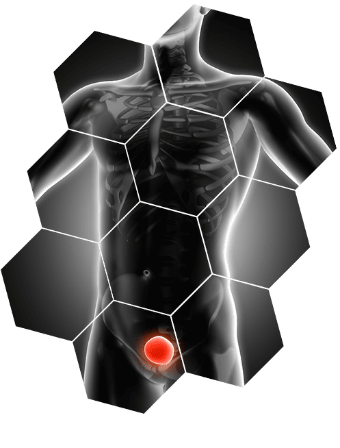 clinica-privada-de-especialidades-urologicas.png